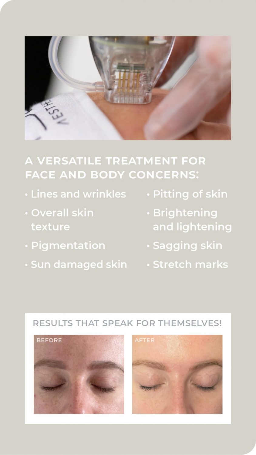3D Dermaforce Allure Laser Clinic